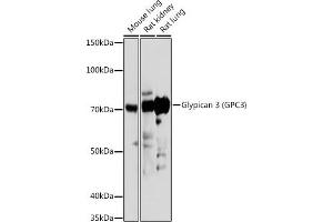 Western blot analysis of extracts of various cell lines, using Glypican 3 (GPC3) (GPC3) antibody (ABIN6127987, ABIN6141306, ABIN6141310 and ABIN6219094) at 1:1000 dilution. (Glypican 3 anticorps  (AA 290-550))