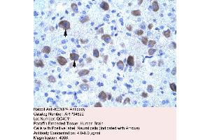 Human Brain (KCNIP4 anticorps  (N-Term))