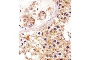 Immunohistochemical analysis of paraffin-embedded H. (EPH Receptor A4 anticorps  (AA 383-417))