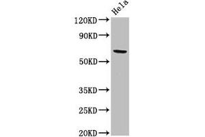 Western Blot Positive WB detected in: Hela whole cell lysate All lanes: ACADVL antibody at 2 μg/mL Secondary Goat polyclonal to rabbit IgG at 1/50000 dilution Predicted band size: 71, 69, 73 kDa Observed band size: 71 kDa (ACADVL anticorps  (AA 403-497))
