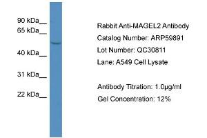 WB Suggested Anti-MAGEL2  Antibody Titration: 0. (MAGE-Like 2 anticorps  (N-Term))