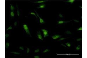 Immunofluorescence of monoclonal antibody to SOD1 on HeLa cell. (SOD1 anticorps  (AA 1-154))