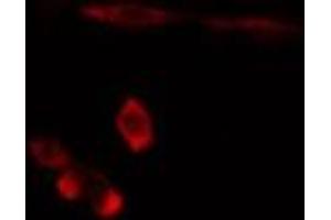 ABIN6275892 staining  Hela cells by IF/ICC. (FTH1 anticorps  (C-Term))