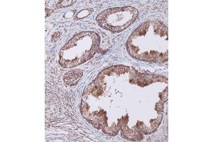 Immunohistochemical analysis of (ABIN656404 and ABIN2845698) on paraffin-embedded Human prostate tissue. (WFDC1 anticorps  (C-Term))