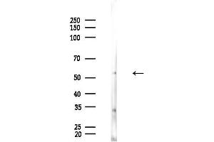 Western blot analysis of lysates from EC304 cells, using TUA Antibody at 1/1000 dilution.