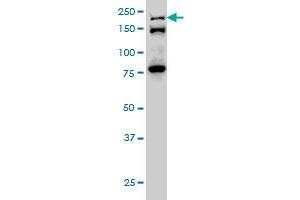 ESPL1 monoclonal antibody (M01), clone 6H6 Western Blot analysis of ESPL1 expression in Hela S3 NE .