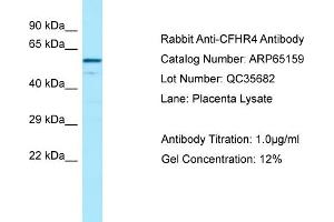 Western Blotting (WB) image for anti-Complement Factor H-Related 4 (CFHR4) (C-Term) antibody (ABIN2790060)