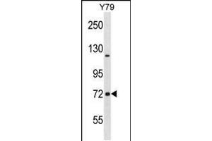 Western blot analysis in Y79 cell line lysates (35ug/lane). (NCDN anticorps  (N-Term))