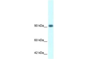 Western Blotting (WB) image for anti-RNA Binding Motif Protein 10 (RBM10) antibody (ABIN2460170) (RBM10 anticorps)