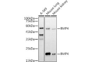 Western blot analysis of extracts of various cell lines, using BMP4 antibody (ABIN6127497, ABIN6137600, ABIN6137603 and ABIN6215157) at 1:1000 dilution. (BMP4 anticorps  (AA 1-408))