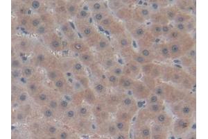 Detection of COL4a1 in Human Liver Tissue using Polyclonal Antibody to Collagen Type IV Alpha 1 (COL4a1)