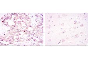 Immunohistochemical analysis of paraffin-embedded ovarian cancer (left) and brain tissues (right) using PRKAA1 mouse mAb with DAB staining.