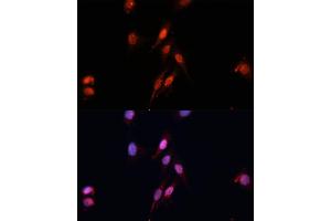 Immunofluorescence analysis of HeLa cells using Smad5 Polyclonal Antibody (ABIN6128714, ABIN6148090, ABIN6148091 and ABIN6218232) at dilution of 1:100 (40x lens). (SMAD5 anticorps  (AA 186-465))