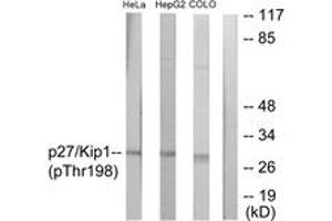 Western blot analysis of extracts from HeLa cells, HepG2 cells and COLO cells, using p27 Kip1 (Phospho-Thr198) Antibody. (CDKN1B anticorps  (pThr198))