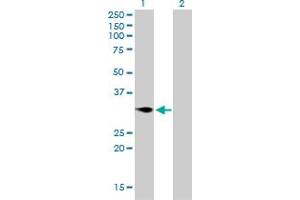 Western Blot analysis of TNFRSF7 expression in transfected 293T cell line by TNFRSF7 monoclonal antibody (M01), clone 1E2-A3.
