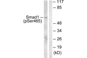 Western Blotting (WB) image for anti-SMAD, Mothers Against DPP Homolog 1 (SMAD1) (pSer465) antibody (ABIN1847221) (SMAD1 anticorps  (pSer465))