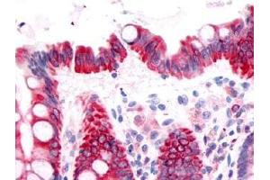 Immunohistochemical staining of prostaglandin D2 receptor on human colon epithelium using antibody