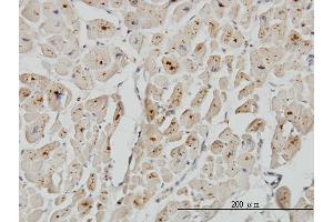 Immunoperoxidase of monoclonal antibody to ASAH1 on formalin-fixed paraffin-embedded human heart. (ASAH1 anticorps  (AA 25-124))