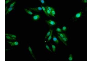 Immunofluorescence staining of Hela cells with ABIN7166389 at 1:100, counter-stained with DAPI. (PADI2 anticorps  (AA 1-665))