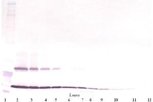 Western Blot (Unreduced) using TSLP antibody (Thymic Stromal Lymphopoietin anticorps)