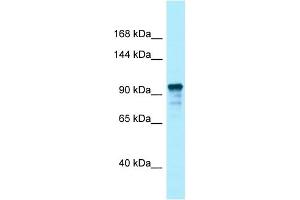 Western Blotting (WB) image for anti-Unc-13 Homolog D (UNC13D) (C-Term) antibody (ABIN2789769) (UNC13D anticorps  (C-Term))