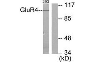 Western blot analysis of extracts from 293 cells, treated with Forskolin 40nM 30', using mGluR4 Antibody. (Metabotropic Glutamate Receptor 4 anticorps  (AA 851-900))