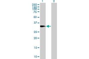 Western Blot analysis of PRKRA expression in transfected 293T cell line by PRKRA MaxPab polyclonal antibody. (PRKRA anticorps  (AA 1-313))