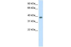 WB Suggested Anti-NEUROD2 Antibody Titration:  0. (NEUROD2 anticorps  (C-Term))