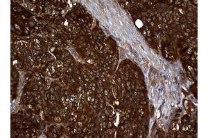 Image no. 9 for anti-Non-Metastatic Cells 1, Protein (NM23A) Expressed in (NME1) antibody (ABIN1499754)