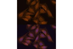 Immunofluorescence analysis of U-2 OS cells using 43711 antibody (ABIN7270204) at dilution of 1:100.