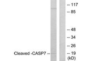 Western blot analysis of extracts from Jurkat cells, treated with Etoposide 25uM 24h, using Caspase 7 (Cleaved-Asp198) Antibody. (Caspase 7 anticorps  (Cleaved-Asp198))