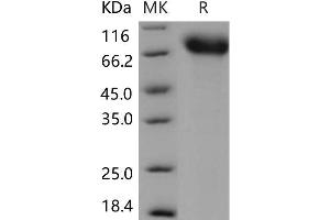 Western Blotting (WB) image for Neurotrophic Tyrosine Kinase, Receptor, Type 1 (NTRK1) (Active) protein (His tag) (ABIN7320045)