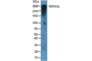 Mouse Capture antibody from the kit in WB with Positive Control: Human lung tissue lysate.