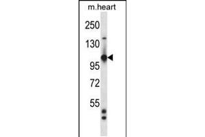 Western blot analysis in mouse heart tissue lysates (35ug/lane).