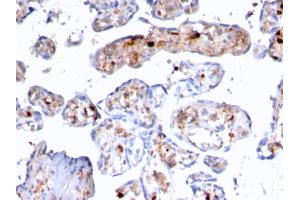 Formalin-fixed, paraffin-embedded human Placenta stained with S100A4 Recombinant Mouse Monoclonal Antibody (rS100A4/1481).
