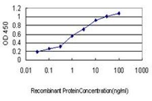 Detection limit for recombinant GST tagged GUCY2D is approximately 0. (GUCY2D anticorps  (AA 521-630))