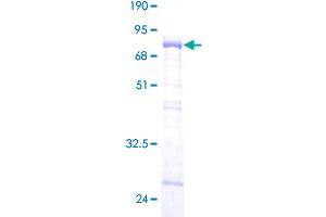Image no. 1 for Muscleblind-like Protein 1 (MBNL1) (AA 1-382) protein (GST tag) (ABIN1310482)