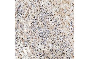 IHC analysis of SNRNP27 using anti-SNRNP27 antibody (ABIN7599614). (SNRNP27 anticorps  (AA 100-155))