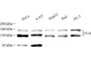 Western blot analysis of VEGF Receptor 3 (ABIN7076194) at dilution of 1: 1000 (Vegf Receptor 3 anticorps)