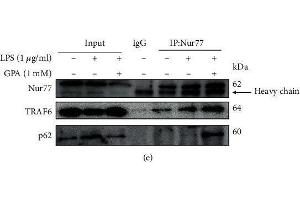 GPA promotes Nur77 to colocalization at mitochondria to induce autophagy.