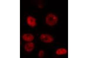 anti-Dual-Specificity tyrosine-(Y)-phosphorylation Regulated Kinase 1A (DYRK1A) (N-Term) antibody