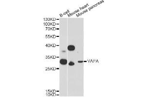 Western blot analysis of extracts of various cell lines, using VAPA Antibody. (VAPA anticorps)