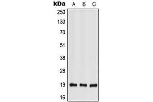 Western blot analysis of IL-28A expression in HEK293T (A), Raw264. (IL28A anticorps  (Center))