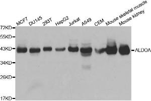Western blot analysis of extracts of various cell lines, using ALDOA antibody. (ALDOA anticorps)