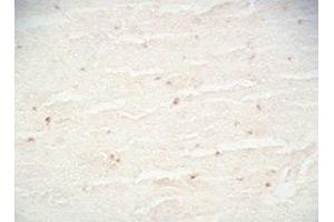 Mouse brain tissue was stained by Rabbit Anti-CB2 Receptor (323-360) Serum (CNR2 anticorps  (AA 323-360))