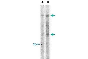 Western blot analysis of ATM in Daudi whole cell lysate with ATM polyclonal antibody  at (A) 1 and (B) 2 ug/mL . (ATM anticorps  (C-Term))