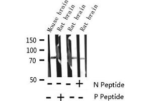 Western blot analysis of Phospho-Synapsin (Ser9) expression in various lysates