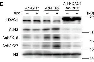 Western Blotting (WB) image for anti-Histone Deacetylase 1 (HDAC1) antibody (ABIN2854776)