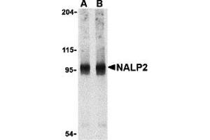Western Blotting (WB) image for anti-NLR Family, Pyrin Domain Containing 2 (NLRP2) (C-Term) antibody (ABIN1030532) (NLRP2 anticorps  (C-Term))
