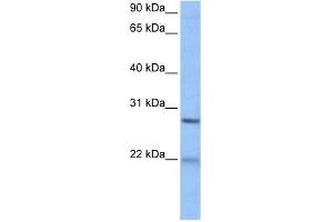 ECT2 antibody used at 1 ug/ml to detect target protein. (ECT2 anticorps  (Middle Region))